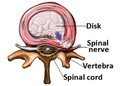 SPINAL CORD AND NERVE